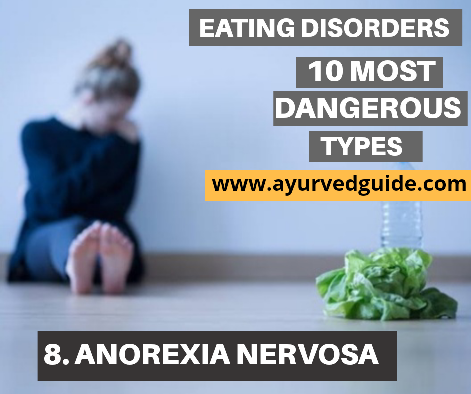 Eating Disorders-Anorexia Nervosa
