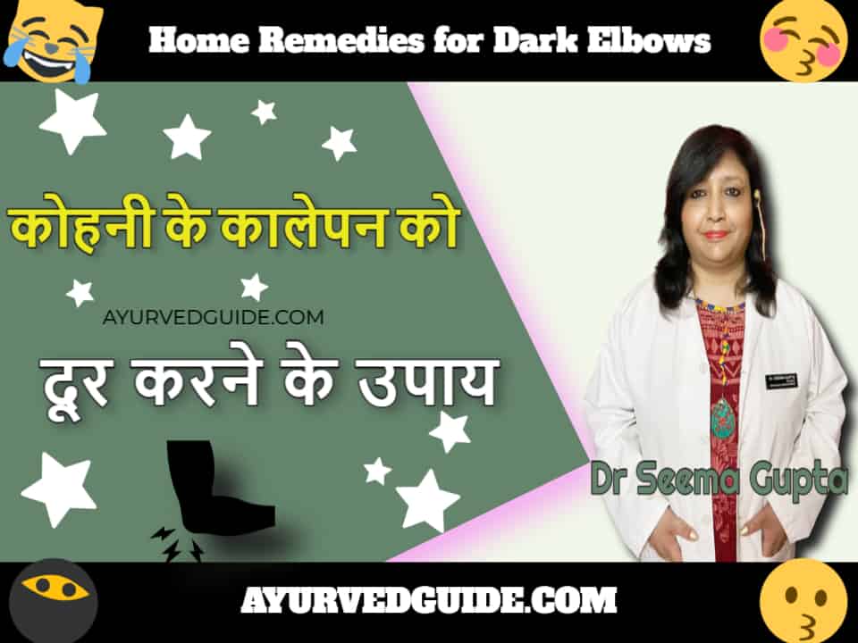 कोहनी के कालेपन को दूर करने के उपाय - Home Remedies for Dark Elbows