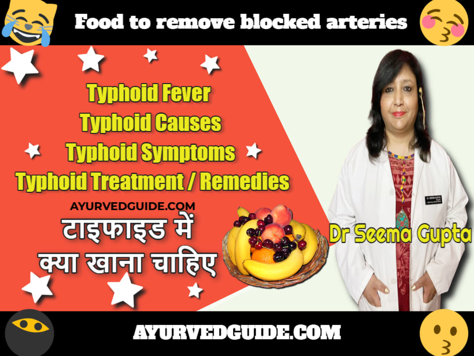Typhoid Fever -  Typhoid Causes - Typhoid Symptoms - Typhoid Treatment - टाइफाइड में क्या खाना चाहिए