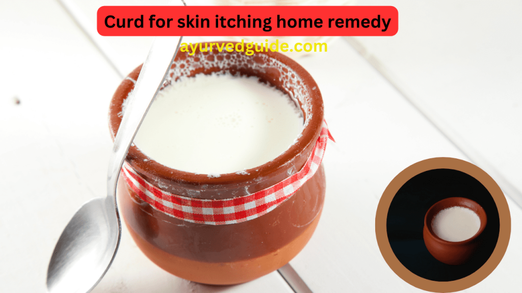Curd for skin itching home remedy